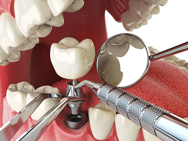 Best Emergency Gum Treatment in Woodfield, SC