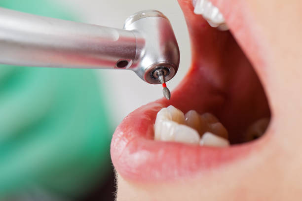 Best Cosmetic Emergency Dentistry in Woodfield, SC